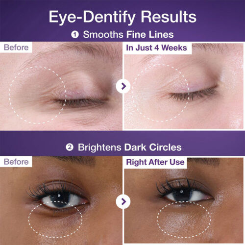 کرم دور چشم NMN + رتینول